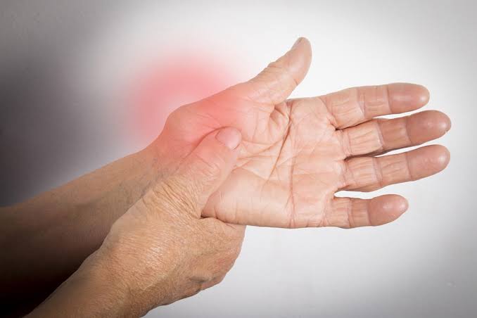 Tratar la artritis en Mexico