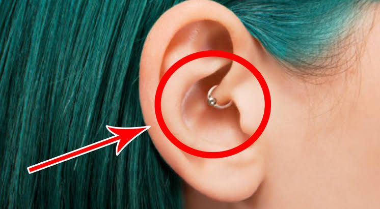 ¿Es efectivo el piercing para la migraña