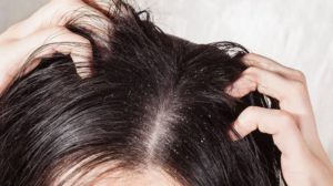 El vinagre blanco puede restaurar tu cabello