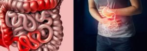 Datos que no conocías sobre la Enfermedad de Crohn