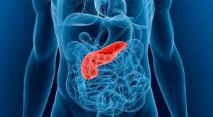 Pancreatitis aguda síntomas, causas y tratamiento