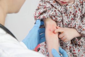 Todo lo que debes saber de la dermatitis