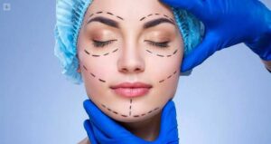 Mitos sobre la cirugía estética que hay que saber