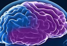 Demencia frontotemporal Demencia frontotemporal