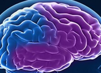 Demencia frontotemporal Demencia frontotemporal