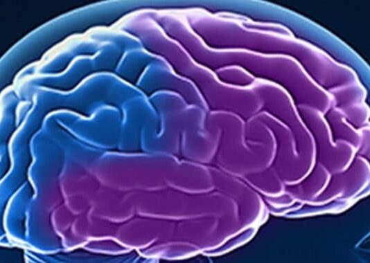 Demencia frontotemporal Demencia frontotemporal
