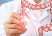 Enfermedades del colon ¿Cómo prevenirlas? Enfermedades del colon ¿Cómo prevenirlas