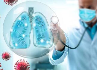 ¿Secuelas después de una neumonía? ¿Secuelas después de una neumonía