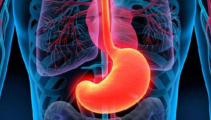 Gastritis erosiva síntomas y causas