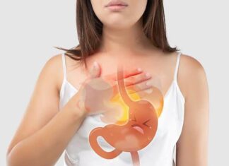 Síntomas de una inflamación en el esófago Síntomas de una inflamación en el esófago