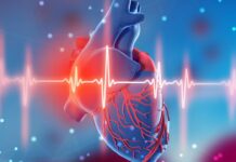 ¿Síndrome del corazón roto? ¿Qué es?