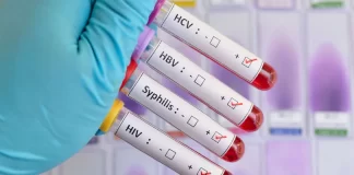 Pruebas de ETS, ¿qué son? Pruebas-de-enfermedades-de-transmision-sexual-¿que-son.