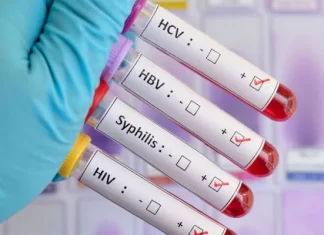 Pruebas de ETS, ¿qué son? Pruebas-de-enfermedades-de-transmision-sexual-¿que-son.