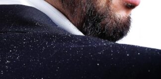 Tipos de caspa, ¿por qué salen? Caspa-¿por-que-sale