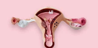 Miomas, el tumor benigno más frecuente en la mujer