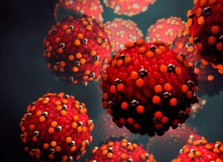 Sarampión, alerta por nuevo brote SARAMPION-ALERTA-POR-NUEVO-BROTE