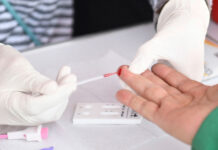 Pruebas de VIH y Sífilis gratis en la CDMX