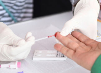 Pruebas de VIH y Sífilis gratis en la CDMX