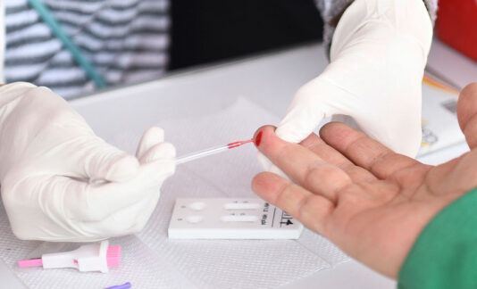 Pruebas de VIH y Sífilis gratis en la CDMX