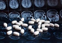 FDA aprueba fármaco en contra del Alzheimer