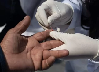 ¿Dónde hacen pruebas de VIH GRATIS en CDMX? Dónde hacen pruebas de VIH GRATIS en CDMX