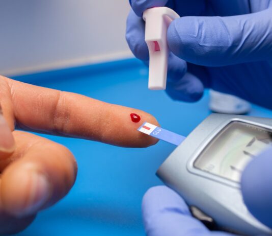 ¿Puede un susto fuerte causar diabetes? Mito o realidad diabetes por susto fuerte