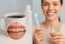 Café y salud dental: cómo esta bebida afecta tus dientes y qué hacer para protegerlos