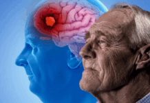 Esperanza desde la ciencia: fármacos para la diabetes podrían ralentizar el deterioro cerebral en pacientes con Alzheimer