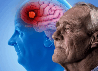 Esperanza desde la ciencia: fármacos para la diabetes podrían ralentizar el deterioro cerebral en pacientes con Alzheimer