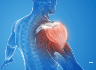 Más allá del manguito rotador: otras causas del dolor de hombro y su diagnóstico dolor de hombro