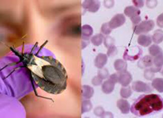 Advierten científicos aumentan los casos de enfermedad de Chagas fuera de América Latina