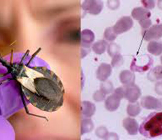 Advierten científicos aumentan los casos de enfermedad de Chagas fuera de América Latina
