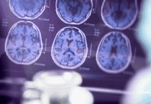 Vivid-Pix dona 100 mil dólares para apoyar a cuidadores y promover la conciencia sobre el Alzheimer Vivid-Pix alzhimer