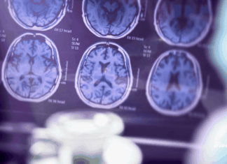 Vivid-Pix dona 100 mil dólares para apoyar a cuidadores y promover la conciencia sobre el Alzheimer Vivid-Pix alzhimer