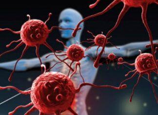 Por qué el riesgo de enfermedades autoinmunes aumenta notablemente después de los 50 años