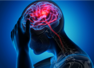 Infarto cerebral en jóvenes: casos aumentan y alertan sobre factores de riesgo en México