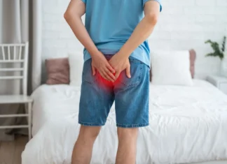 Hemorroides: causas, prevención y tratamiento que debes conocer hemorroides salud y bienestar