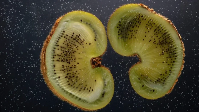 alimentos riñones