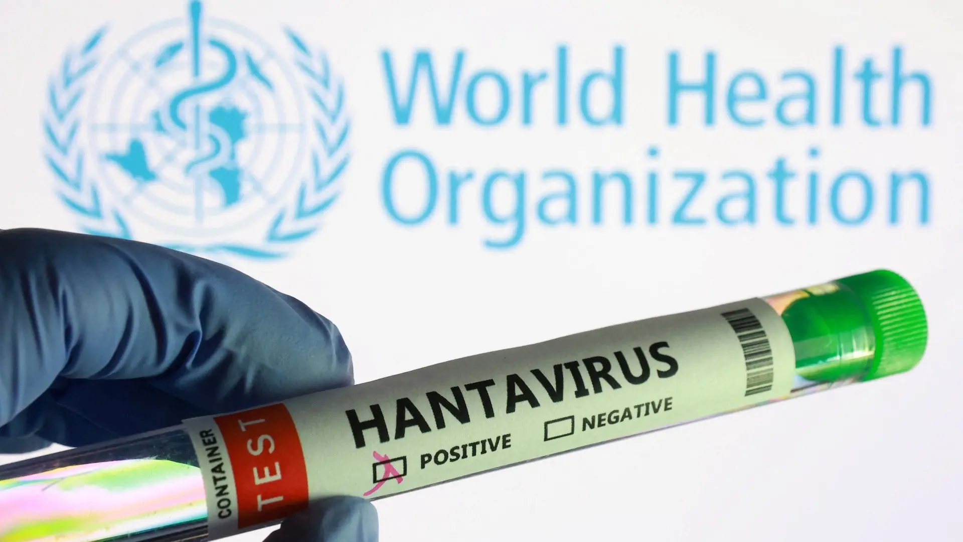 Estos son los países con casos confirmados de hantavirus