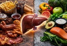 Hígado graso: los alimentos cotidianos que podrían acelerar el daño hepático sin que lo notes