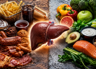 Hígado graso: los alimentos cotidianos que podrían acelerar el daño hepático sin que lo notes