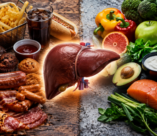 Hígado graso: los alimentos cotidianos que podrían acelerar el daño hepático sin que lo notes