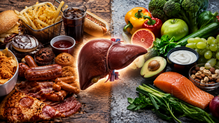 Hígado graso: los alimentos cotidianos que podrían acelerar el daño hepático sin que lo notes