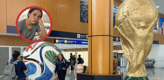 OPS lanza alerta sanitaria rumbo al Mundial 2026: pide reforzar vacunación y vigilancia contra el sarampión noticias Mundial 2026 sarampión