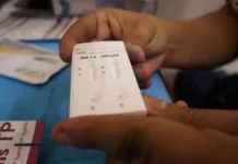 AICM instala pruebas gratis de VIH rumbo al Mundial 2026 pruebas de vih en el AICM