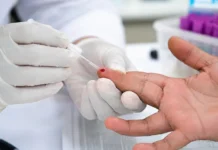 México garantiza tratamiento gratuito contra el VIH y busca eliminarlo para 2030 VIH