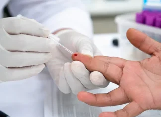 México garantiza tratamiento gratuito contra el VIH y busca eliminarlo para 2030 VIH