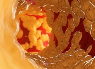 Arterias obstruidas: 10 señales de alerta que pueden advertir problemas cardiovasculares arterias obstruidas