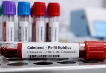 Edición genética logra reducir hasta 50% el colesterol LDL durante un año en estudio experimental colesterol