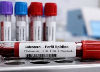 Edición genética logra reducir hasta 50% el colesterol LDL durante un año en estudio experimental colesterol
